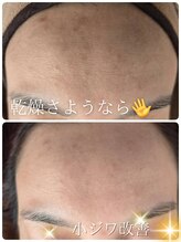 サロン ド ハニー(Salon de Honey)/小じわ改善◎