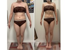 ヴェリティー(Verity)/ビフォーアフター