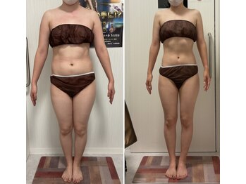 ヴェリティー(Verity)/ビフォーアフター