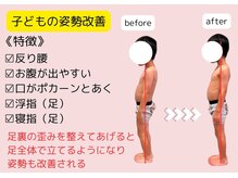 フーレ(Foule)/【子どもの姿勢改善】