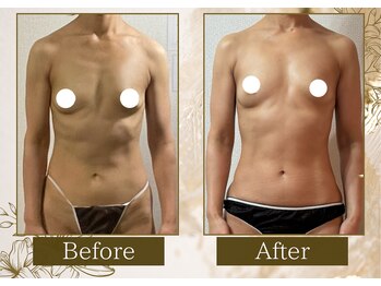 マリン(MARINE)/1年８ヶ月でここまで変わる♪