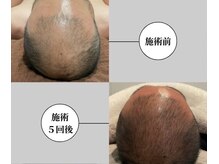 男性のお客様も急増中！肌、髪お悩み解決します♪多数実績あり◎