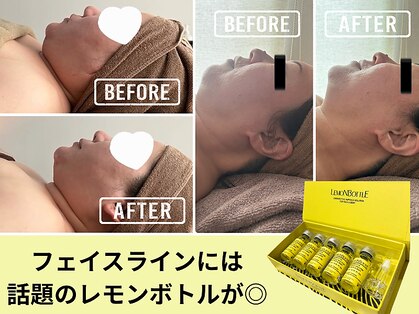 ヘッテ(Hette)の写真