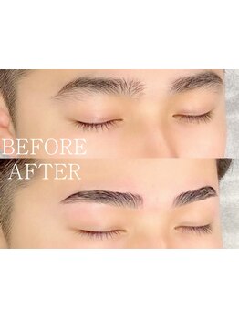 メンズフェイシャル