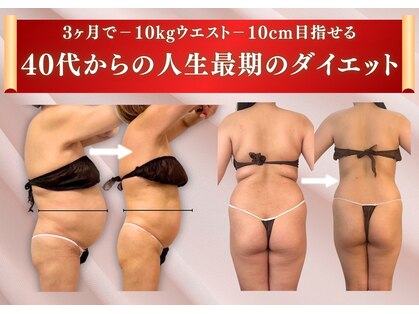 ヴィアス(VIAS)の写真