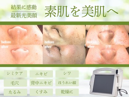 サンティエ(Santie)の写真