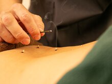 森井鍼灸整体/