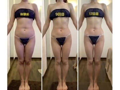 エステティックジュネス(JEUNESSE)の写真