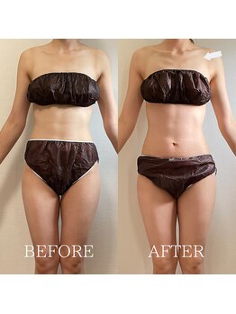 ブルーム(BLOOM)/ブライダルエステ