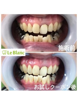 ルブラン 奈良店(Le Blanc)/年齢関係なく！