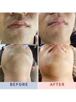 デン(DEN)/ビフォアフター