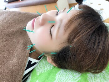 紫原鍼灸整骨院/鍼灸【美容鍼】