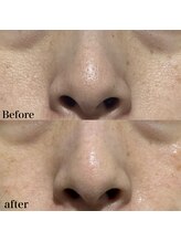 ヒール(heal)/症例