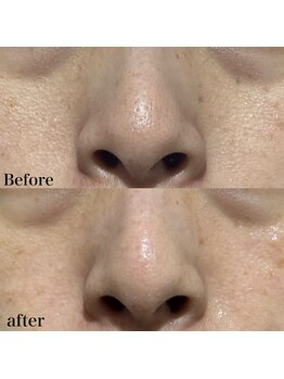 ヒール(heal)/症例