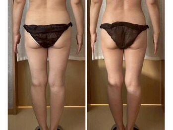 ココア(CoCoa)/活性リンパ洗浄