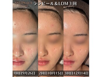 サロン ド エス アオヤマ(SALON DE S AOYAMA)