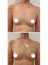 スマイルクルー(SmileClue)/ビフォーアフター症例