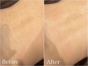 ジョエルワックス 沖縄那覇店(JOELLE WAX)/腰周りのムダ毛脱毛しませんか★