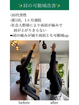 オルカ整体院(ORCA整体院)/【鹿児島/肩こり】