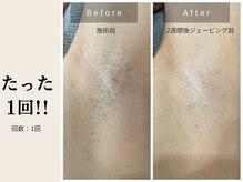 サロン ルイス アディクト(salon Lewis Addict)/