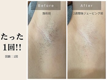 サロン ルイス アディクト(salon Lewis Addict)/