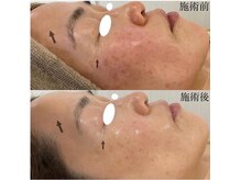 フォーユー マシバメディカル(For You Mashiba Medical)の雰囲気（不要な角質を取り除くとこうなる！！）