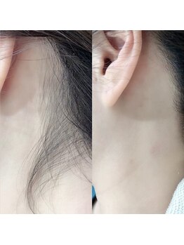 ヘアーデザイン レーゲンボーゲン(REGENBOGEN)/うなじwax