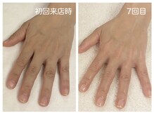 キレイテ 上野店/40代/7回目【ハンドケア上野】