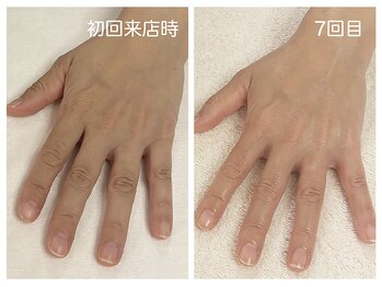 キレイテ 上野店/40代/7回目【ハンドケア上野】