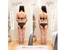 トトノエル(TOTONOEL)の雰囲気(全身強力筋膜リリース&赤外線による脂肪ケアでみるみるスッキリ)