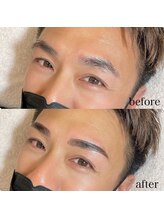 ダリ(Dali)/メンズハリウッドブロウリフト