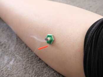 ラフテル鍼灸整骨院/整体×鍼灸も人気です！