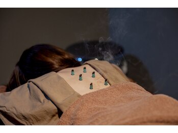 カラダキュア 東京銀座/お灸2