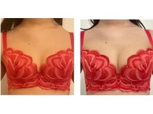 エスビューティー 三軒茶屋(S beauty)/バストケア・駒澤大学・痩身