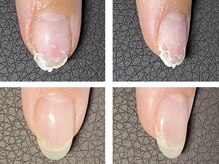 オズ ネイルアンドアイ(OZ NAIL&EYE)/薄くて弱い爪も補修出来ます。
