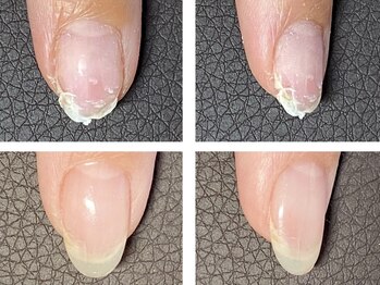 オズ ネイルアンドアイ(OZ NAIL&EYE)/薄くて弱い爪も補修出来ます。