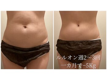 ヨサパーク カルム(YOSA PARK)/見た目の変化◎