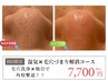 初回限定【目立つ黒ずみに】毛穴洗浄＆集中吸引70分円7700円