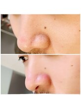 モアビューティ 庚午店(MORE BEAUTY)/