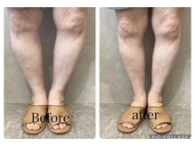 足トラブル対応年間1600件実績有◎#足痛#足指変形#O脚#膝痛#骨盤