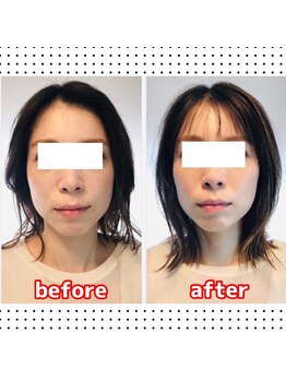 ほぐし堂 琳然《もみほぐし/ヘッドスパ/足つぼ/肩こり》/タイSENヘッドセラピー