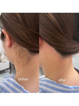 ドゥースケー ビューティー(doucek beauty)の写真/本厚木で脱毛を始めるなら！プロが毛質を見極め最適な方法をご提案。納得して始められるオーダーメイド施術