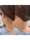 ドゥースケー ビューティー(doucek beauty)の写真/本厚木で脱毛を始めるなら！プロが毛質を見極め最適な方法をご提案。納得して始められるオーダーメイド施術