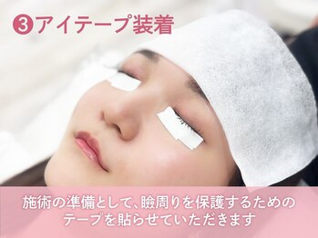リラ 高崎店(Lila)/3.アイテープ装着