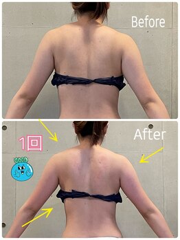 エクセレントビューティーサロン 艶(EN)/ブライダル１回