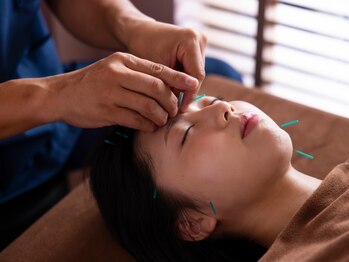 ココロ(CoCoLo)の写真/≪予約困難≫【人気No.1本格美容鍼☆】骨格からアプローチし小顔効果・エイジングケア◎その他不調にも♪