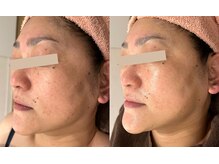 エス(es)/ビフォーアフター