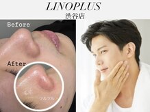 リノプラス 渋谷店(LINOPLUS)/肌ワックス