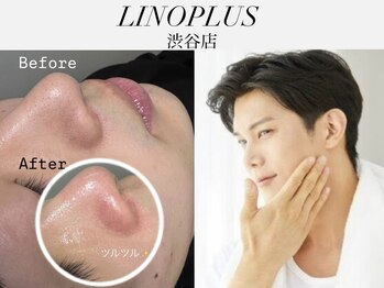 リノプラス 渋谷店(LINOPLUS)/肌ワックス