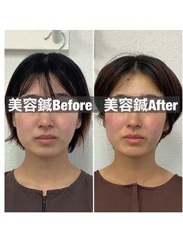 ハリサロンドオフ 堺東店(hari salon de off)/お客様before→after